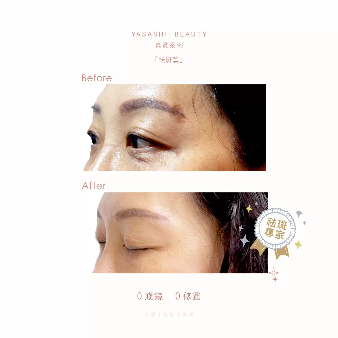 A sales kit of beauty treatment, bright, simple-7- (English)